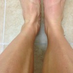 Right tendon is swollen