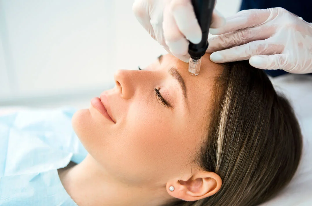 collagen induction therapy copy.jpg
