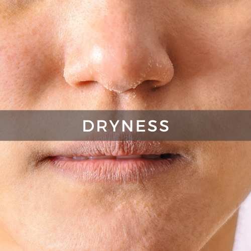 Dry Skin Concerns 