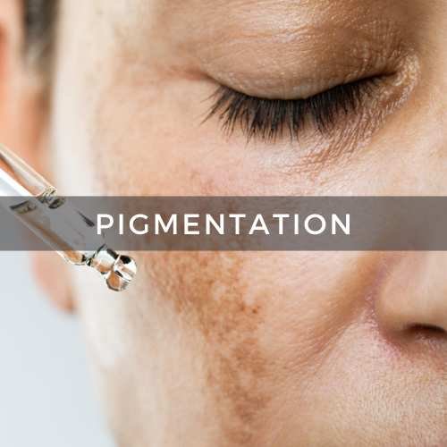 Pigmentation & hyperpigmentation