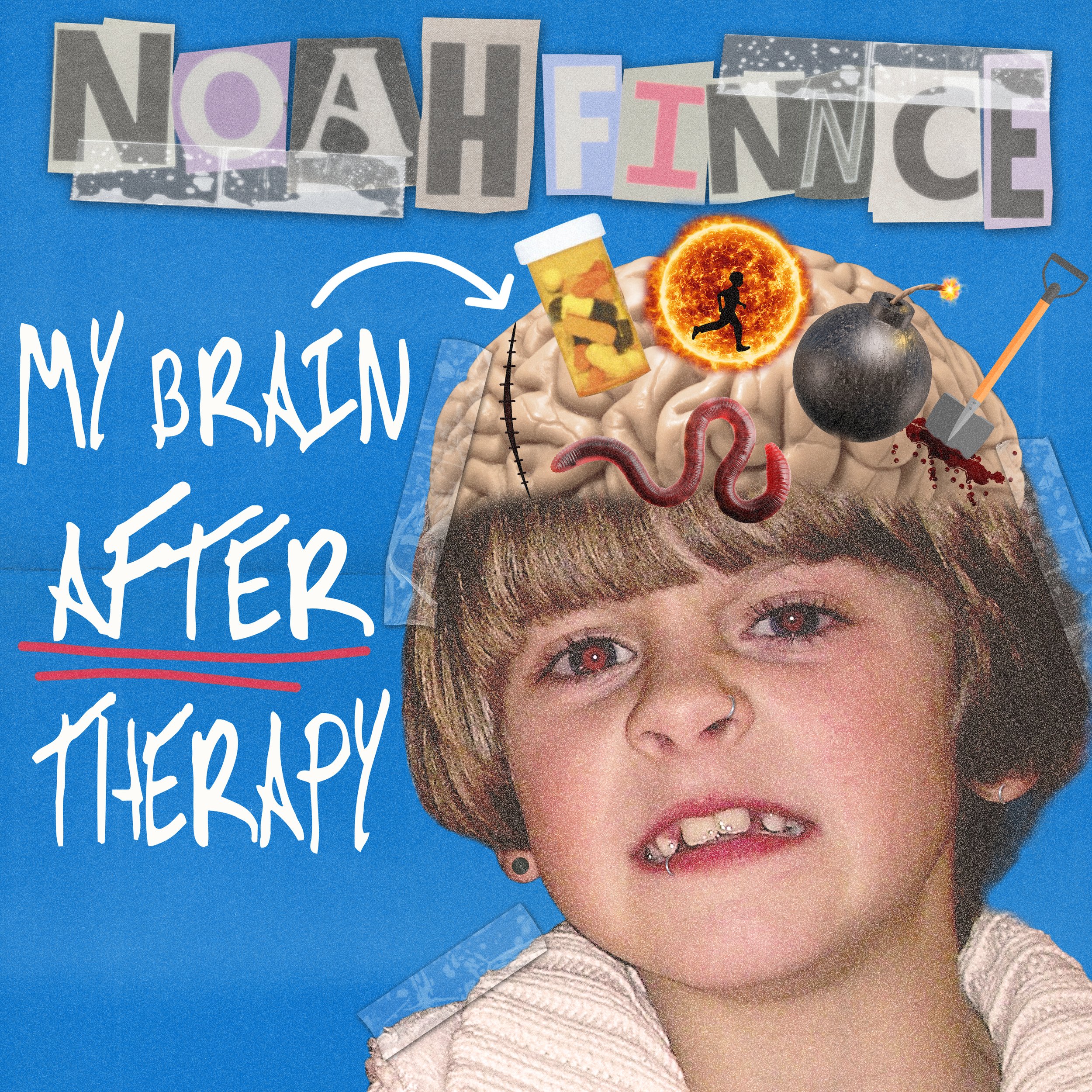 NOAHFINNCE - MY BRAIN AFTER THERAPY