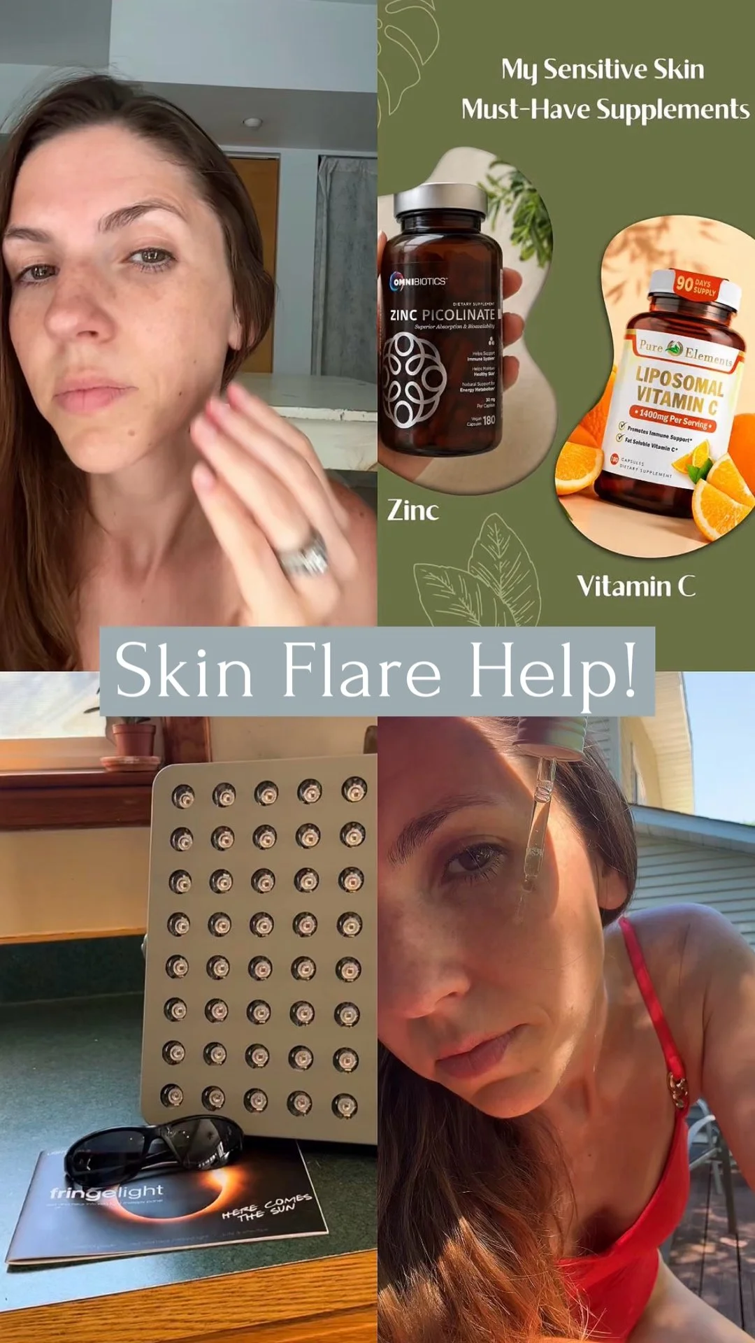 My Sensitive Skin Journey: Products &amp; Tips That Are Actually Helping