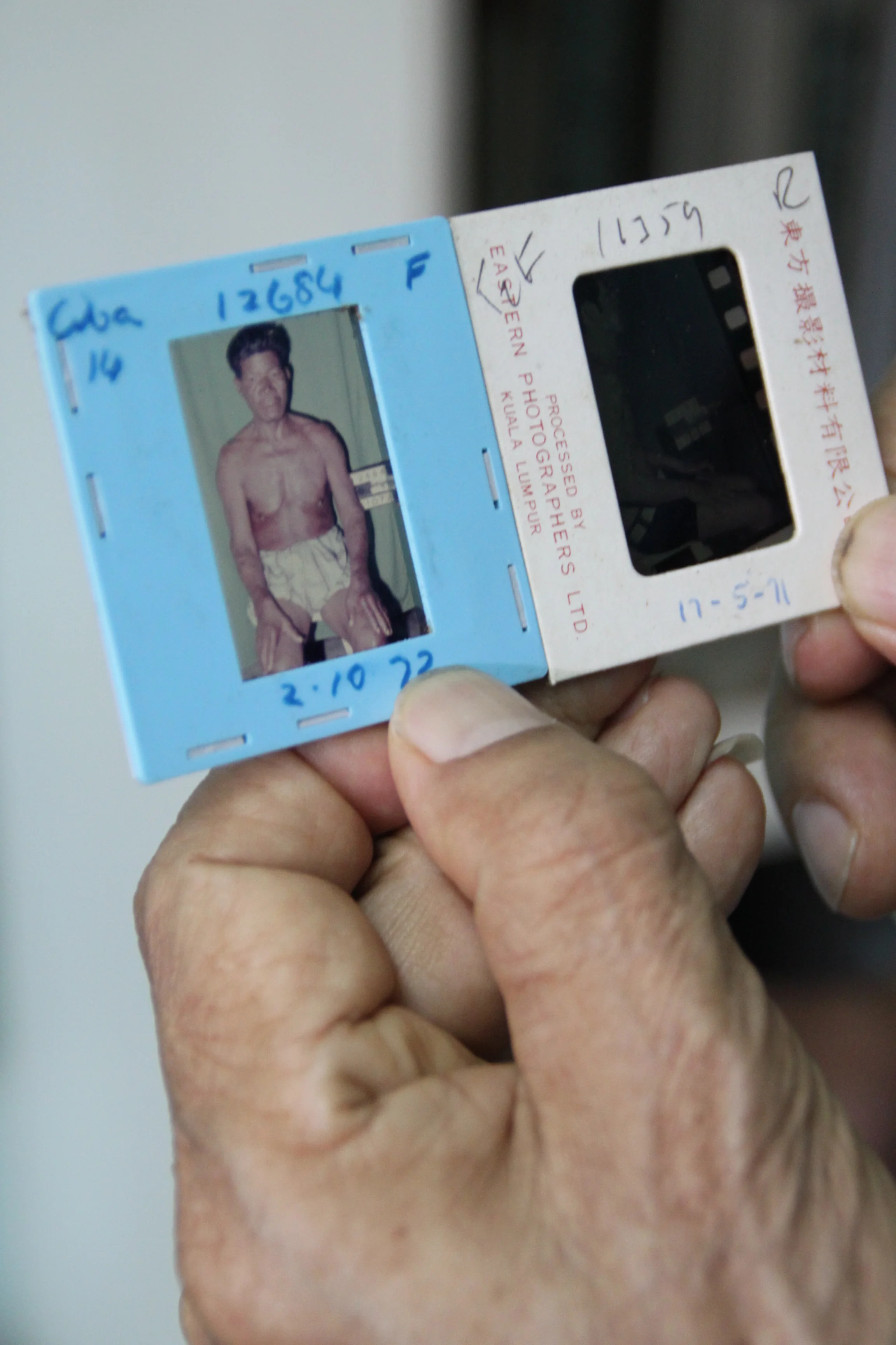 Slides of the patients upon admission. (photo by Tan Ean Nee)
