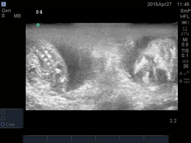 The spine of one fetus and the skull of another. ©John Hoogland 2015