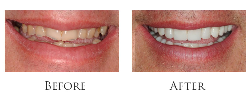 dr-reese-smile-makeover-gallery-9.jpg