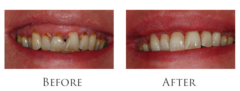 dr-reese-cavity-gallery-2.jpg