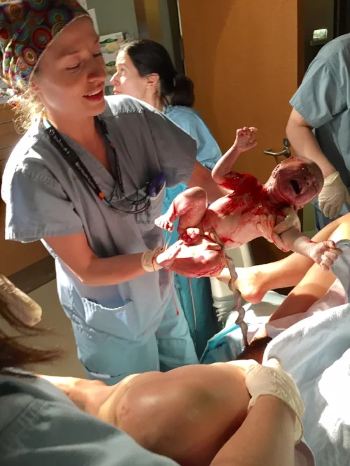 Look at that umbilical cord!