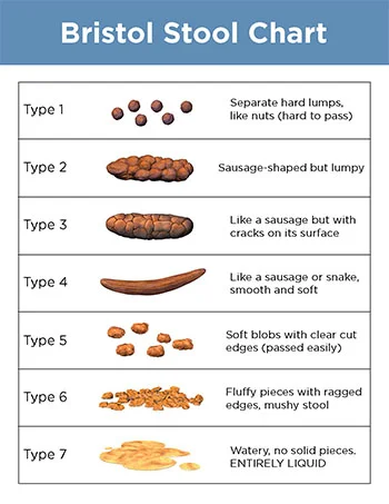 You may be asked to look at a Bristol stool chart to describe your poop’s consistency. Type 3 & 4 are considered ideal