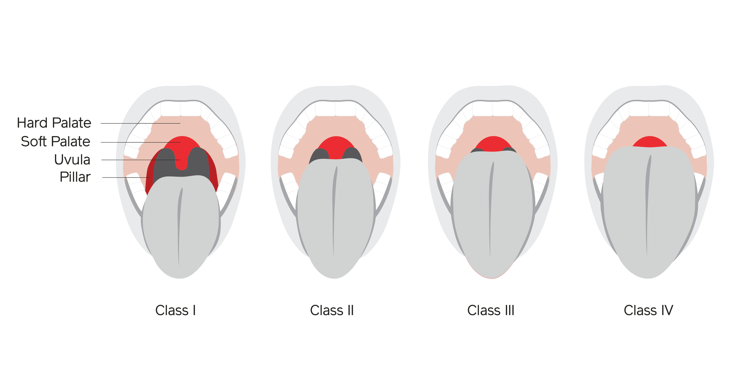 Airway001.png