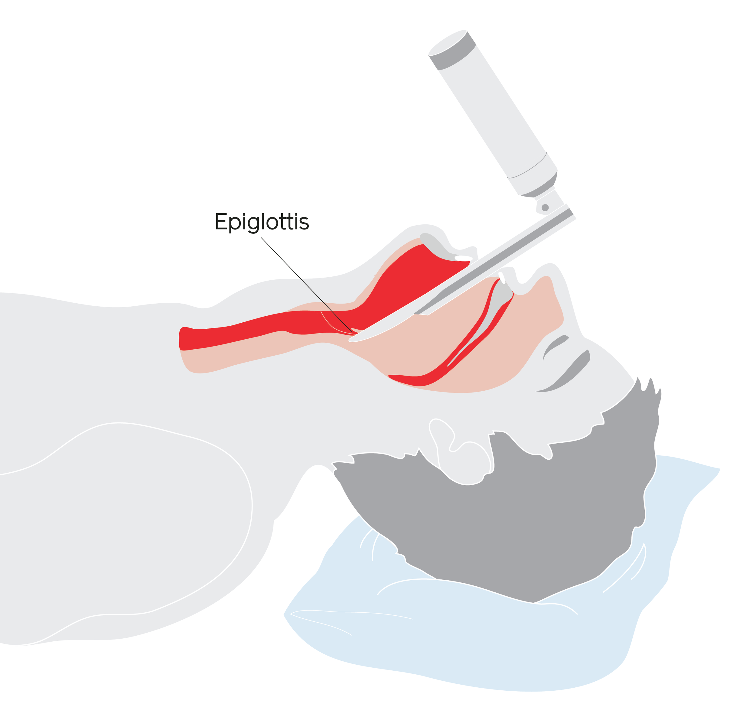 Airway002.png