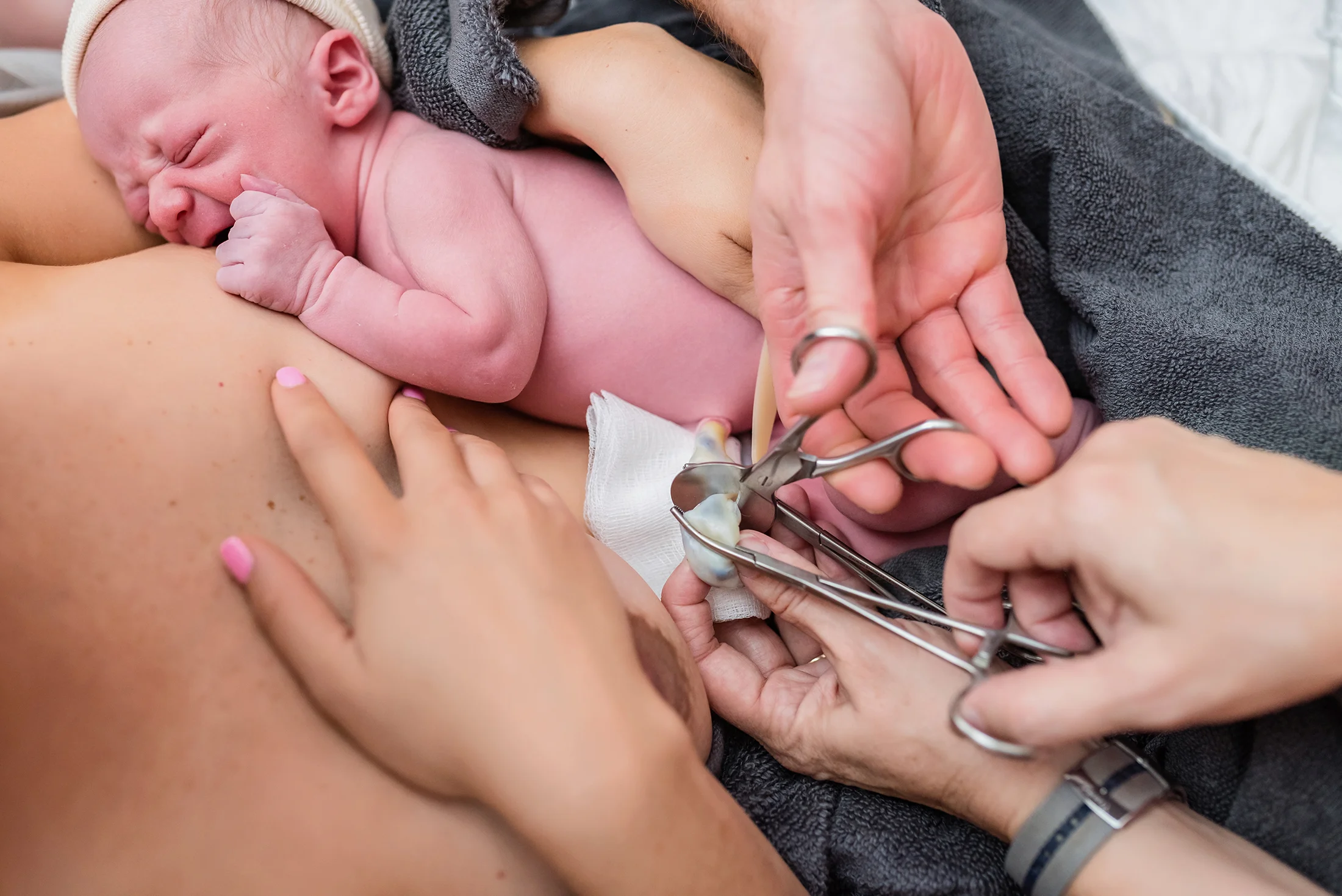 cutting the umbilical cord