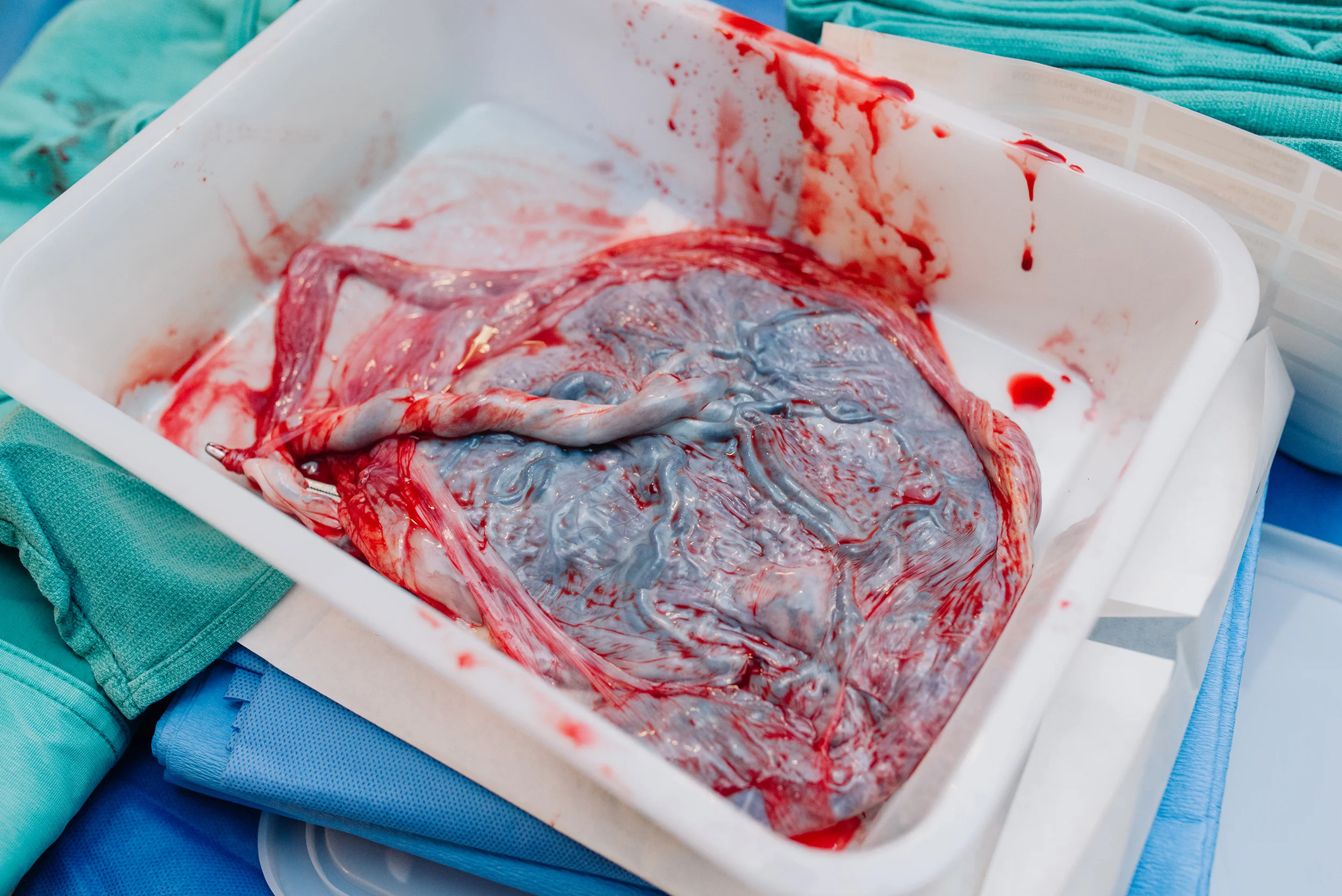 amazing-human-placenta.jpg