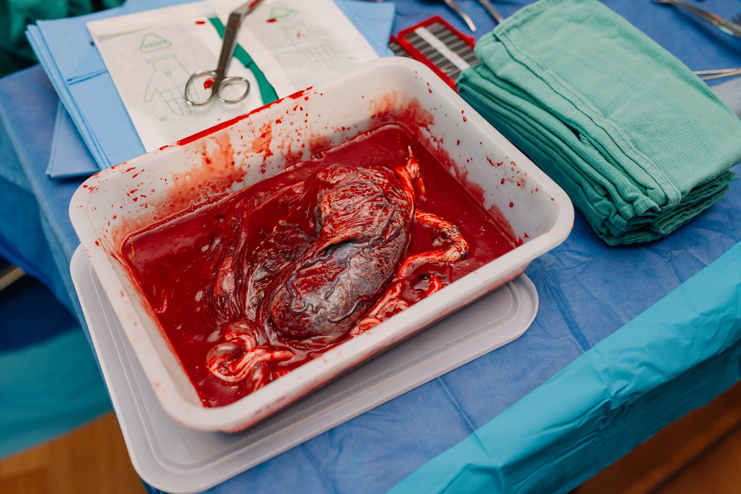placenta-afterbirth-austin.jpg