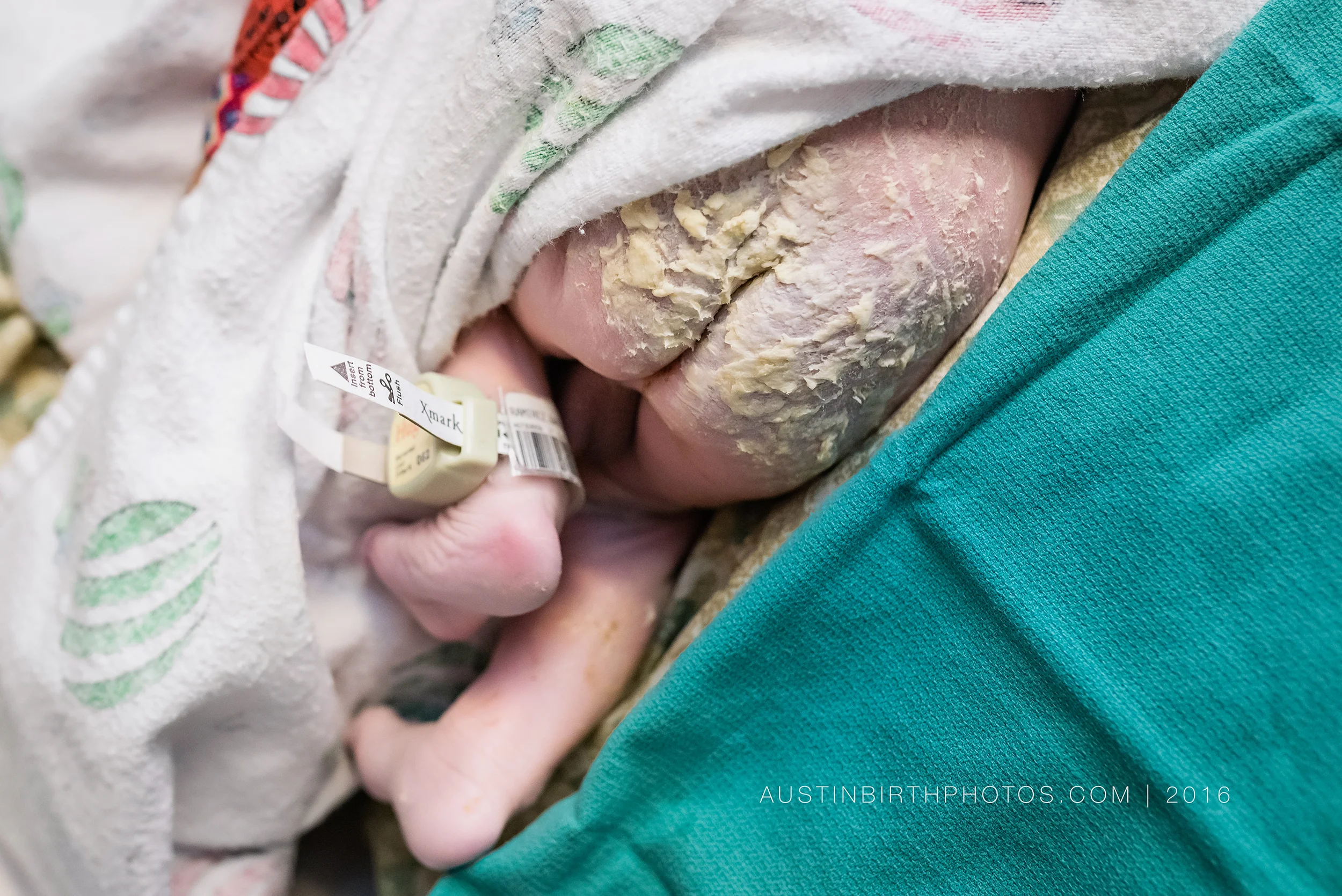 vernix-caseosa.jpg