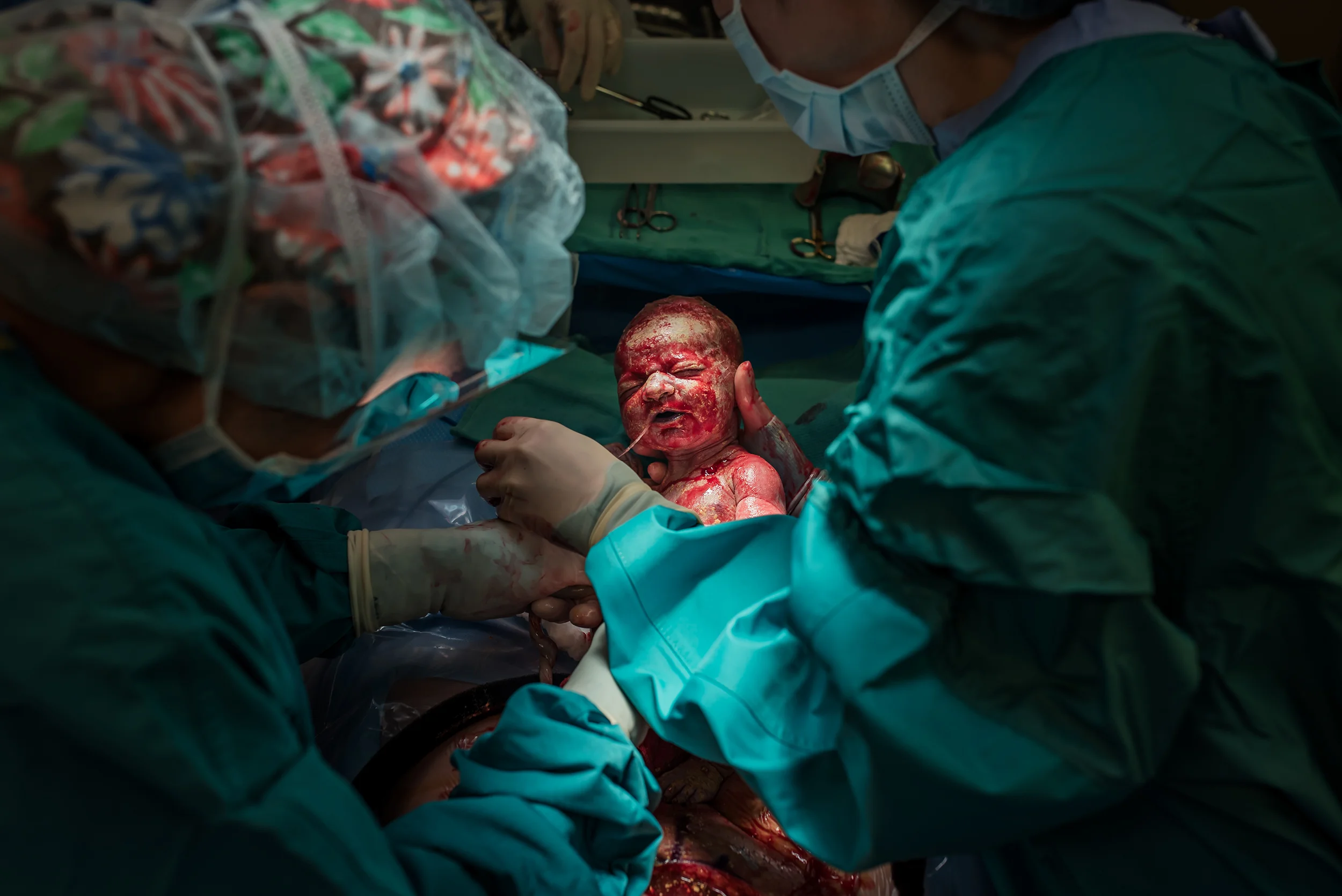 austin c-section birth st davids