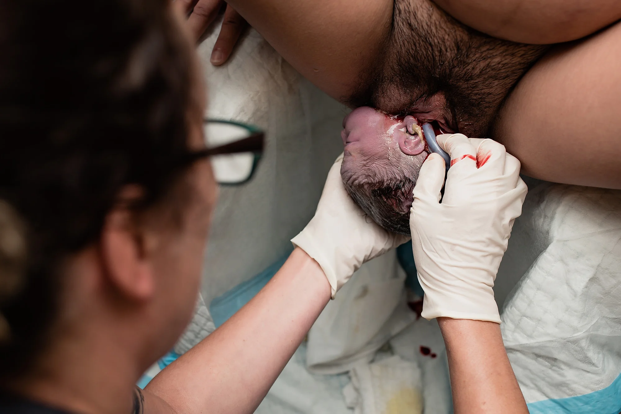 birth crowning nuchal cord austin photographer.jpg