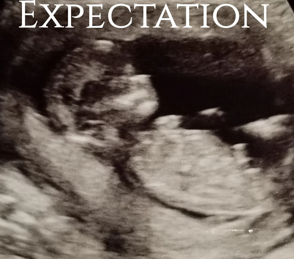 Expectation