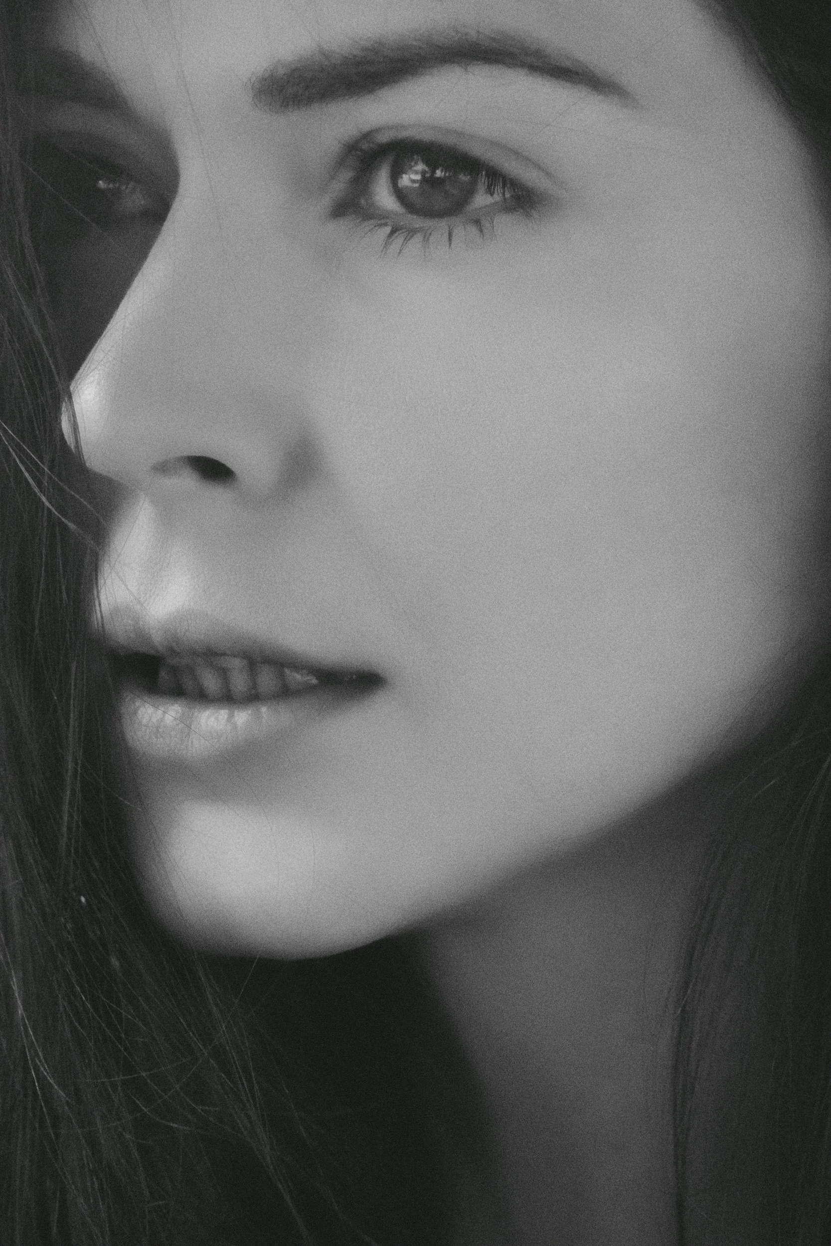 chin laser hair removal