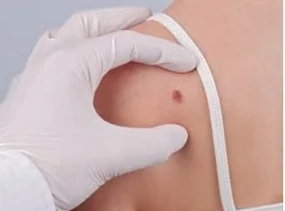 dermatoloog.jpg
