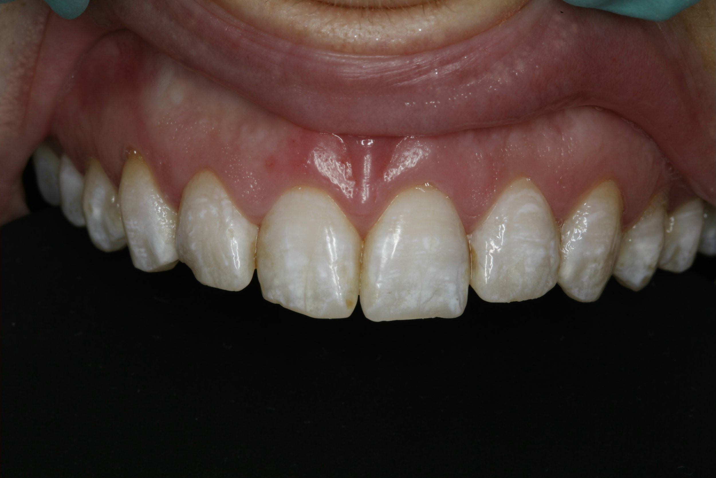Restorative Dentistry - before 