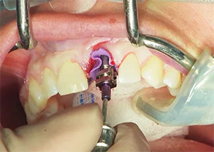 live-surgery.jpg