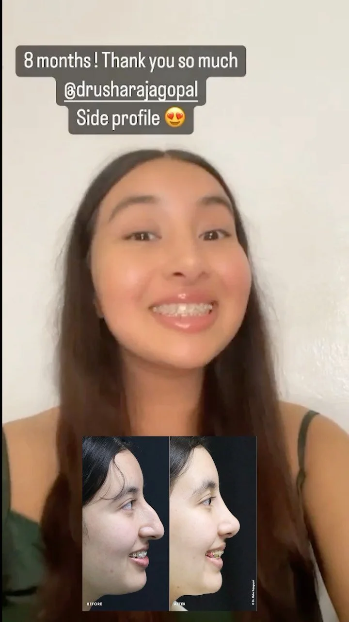 MaletoFemale (MTF) Sex Reassignment Surgery Usha Rajagopal, MD