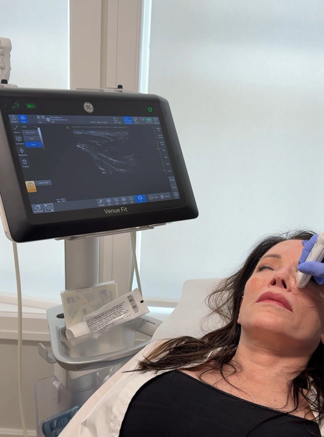 Did you know? We're one of the few clinics using ultrasound-guided technology to safely dissolve unwanted filler.

This technology allows us to safely target and effectively treat:

- Pillow face/chipmunk cheeks
- Filler migration
- Botched filler
- 