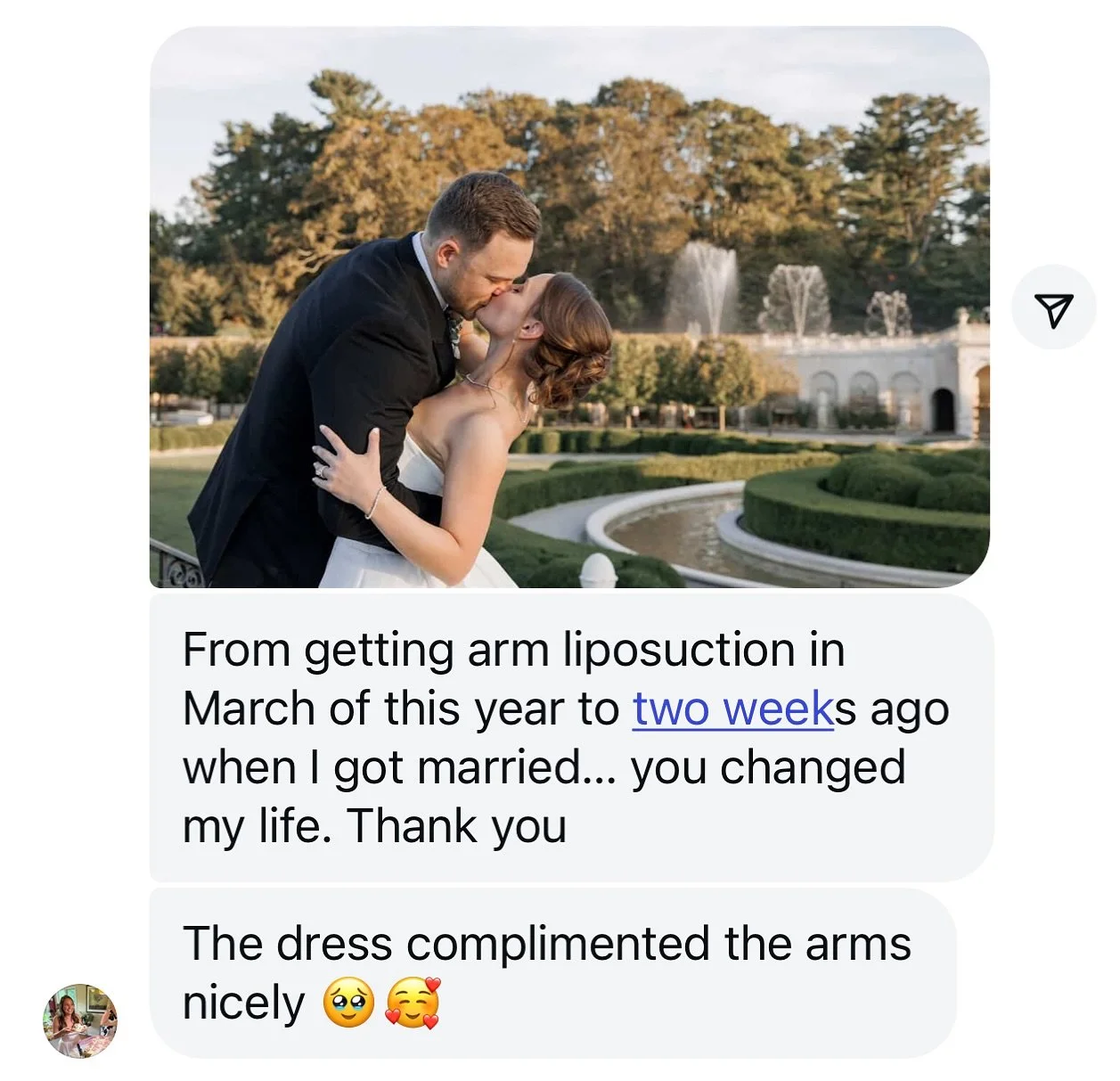 The best compliment we can receive!! 🥰 Our beautiful patient felt confident in her dress and looked radiant on her big day. Wishing our stunning bride a lifetime of joy. Thank you so much for sharing this with us!

Book a consultation to explore you