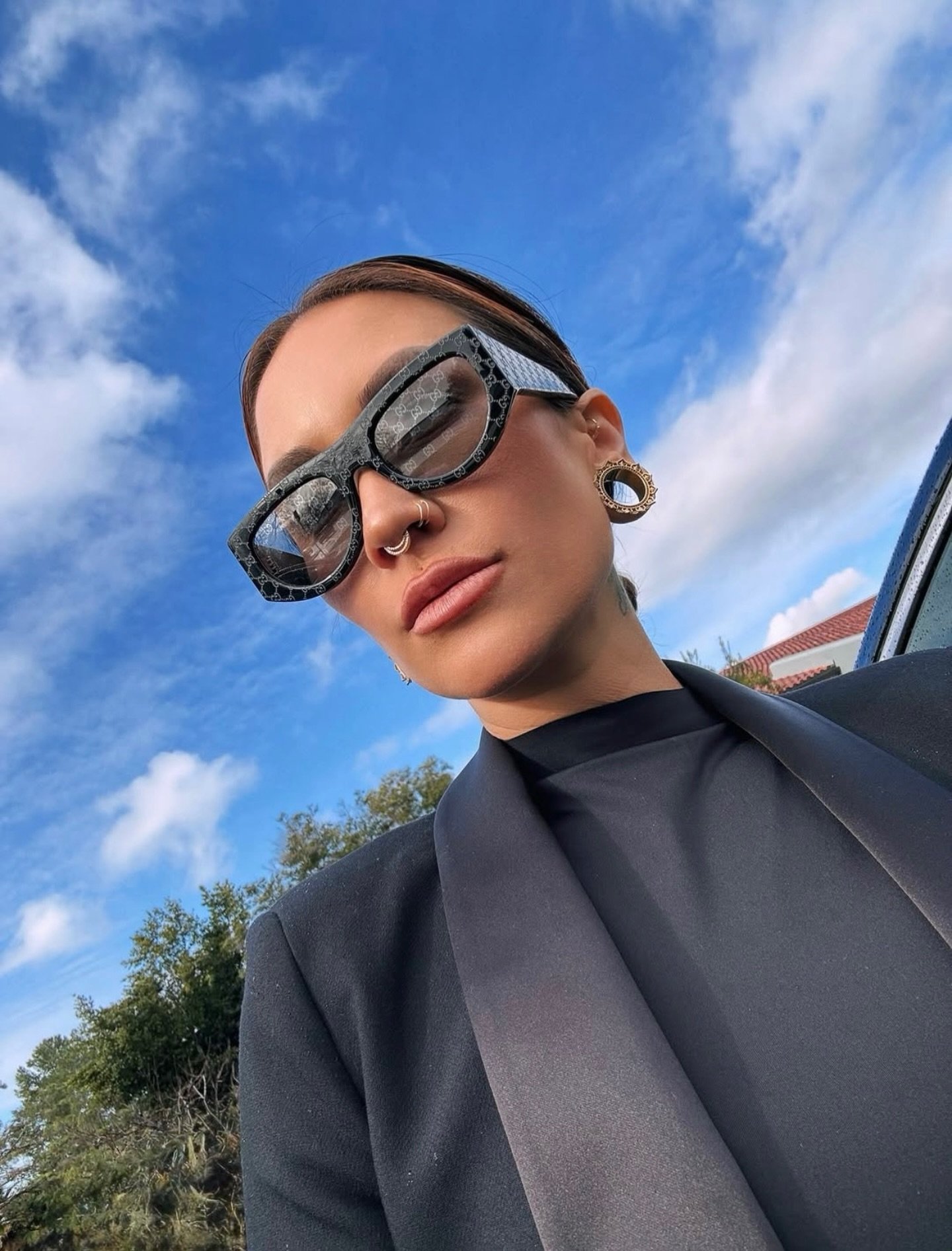 Our beautiful patient! 🔥 We used Evolysse Form to bring more volume and structure to her lips and some Radiesse for mid-face rejuvenation.

Thank you for sharing your selfie with us @chloerainwatermua 🫶