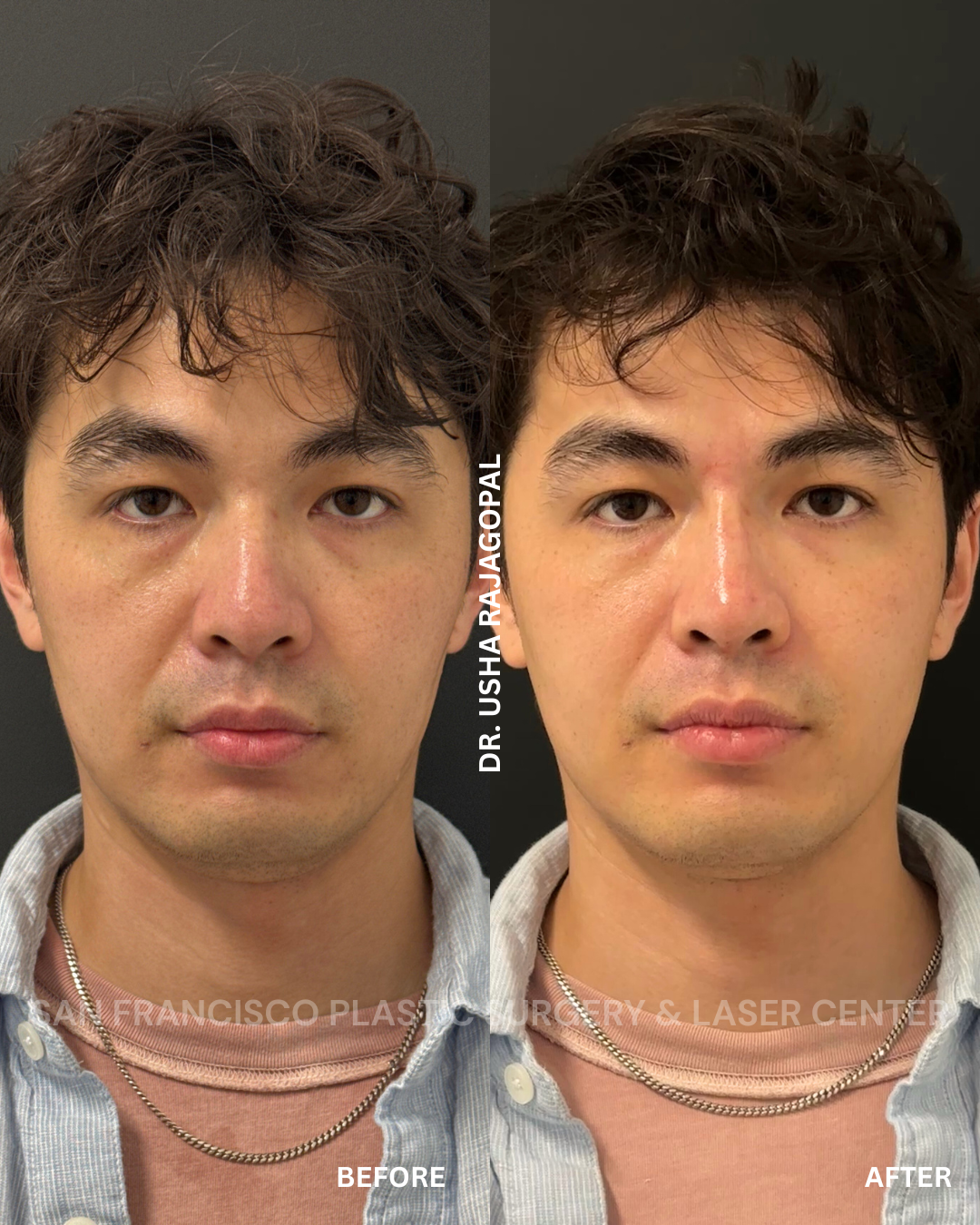 2.png (Copy) (Copy)