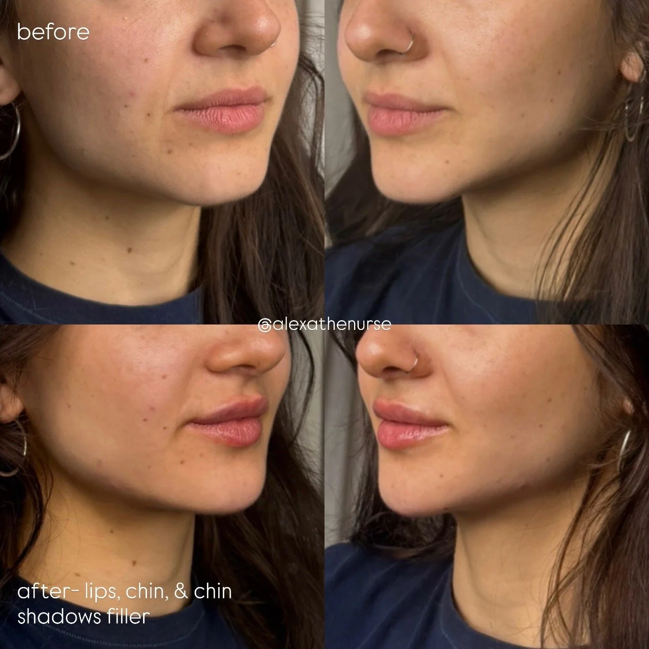 alexa before after 10.jpeg