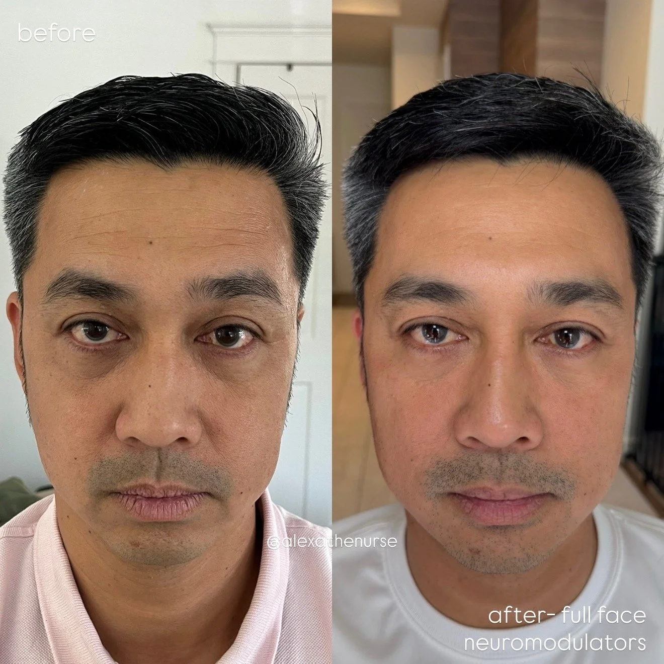 alexa before after 1.jpeg