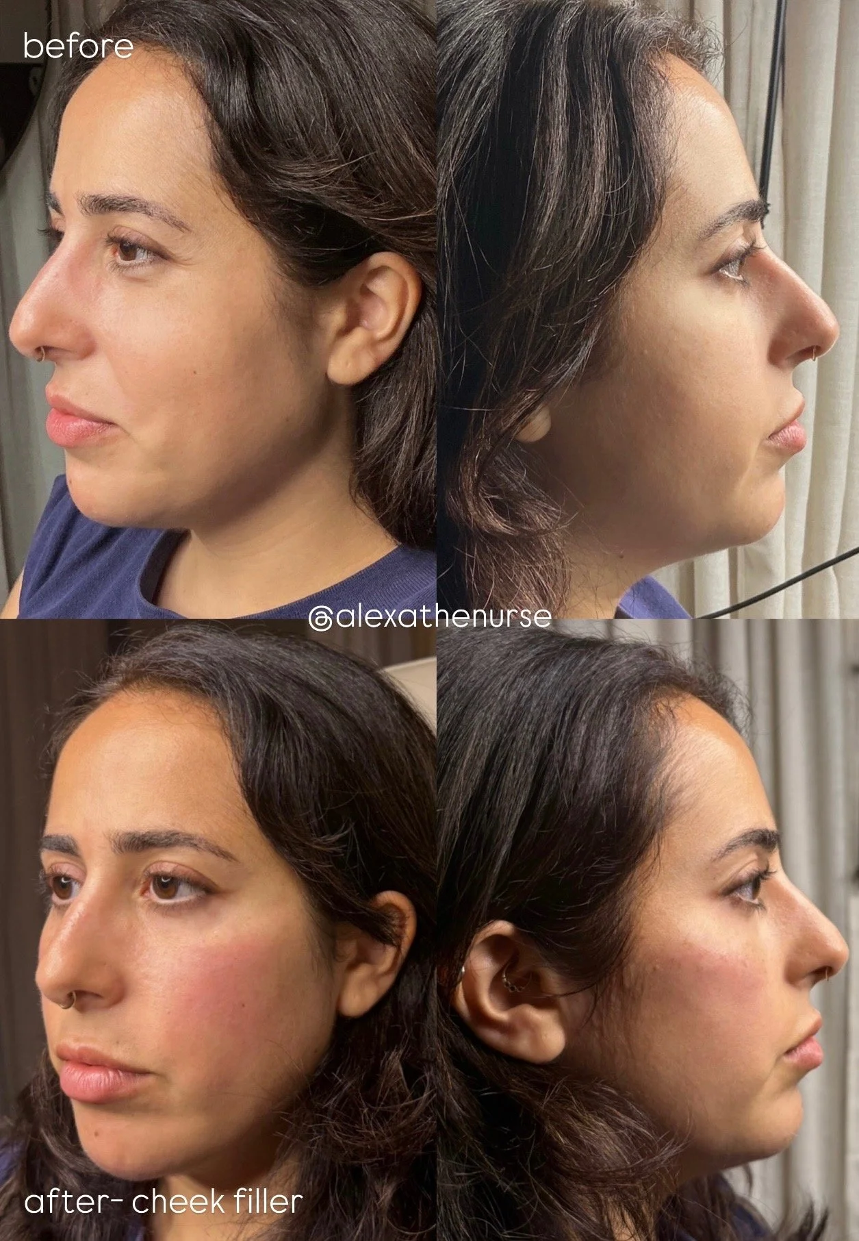 alexa before after 5.jpeg