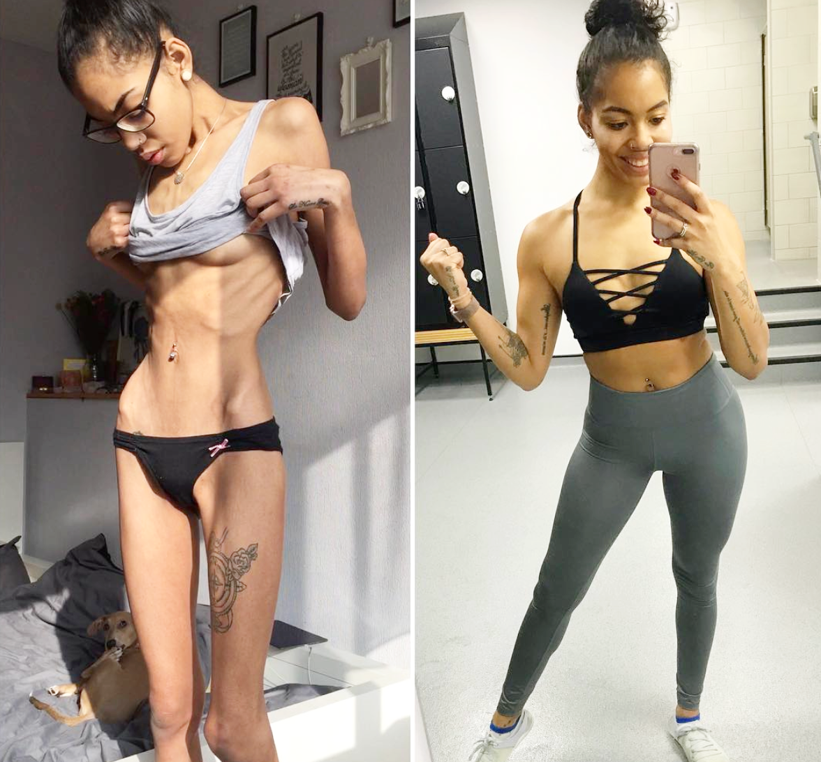 From Anorexia to Fitness Inspiration - How Holly Griffiths Transformed her  life — Tameika G