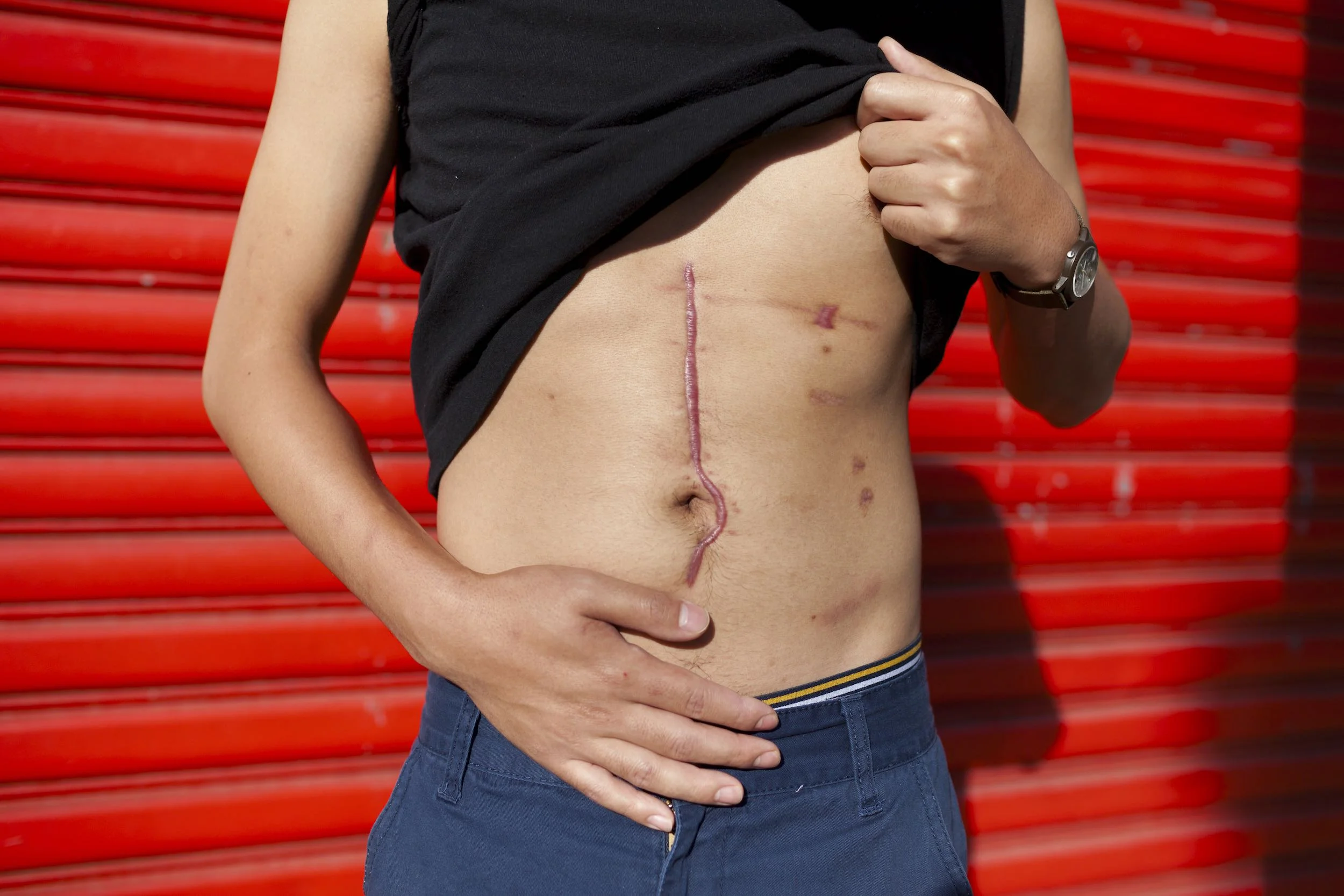 Antonius Wiriadjaja was struck by a random bullet as he walked down a crowded Brooklyn street. The intended target was the ex-girlfriend of the shooter. Brooklyn, New York, 2013 
