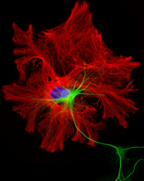 astrocyte-motor neuron co-culture