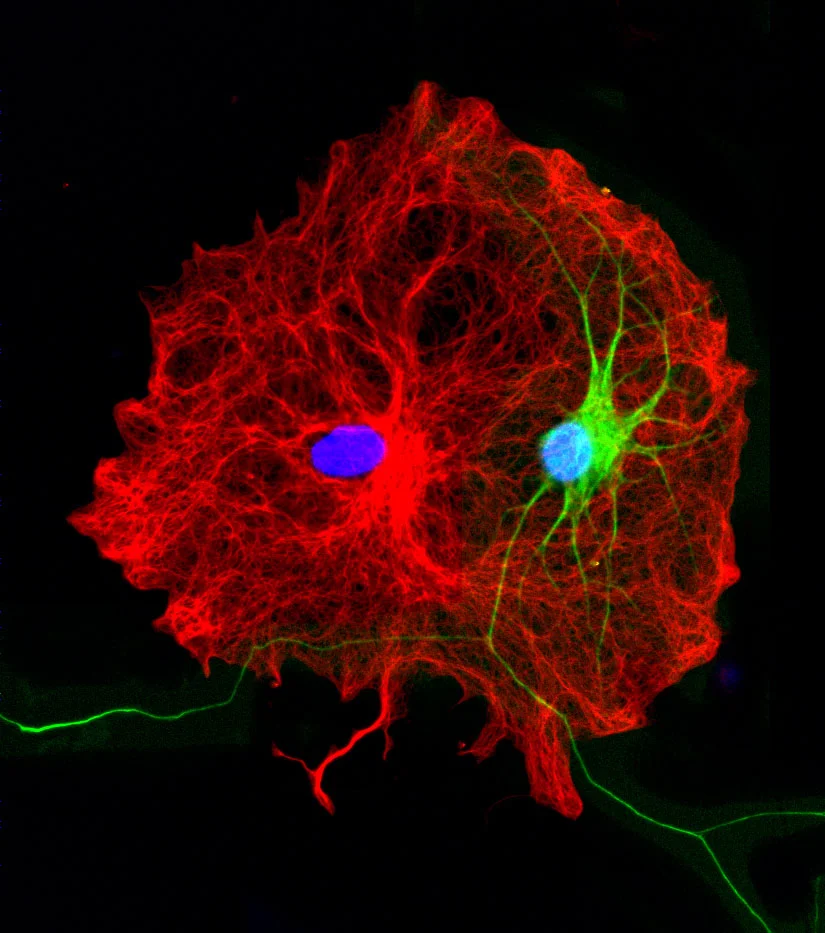 astrocyte-neuron co-culture