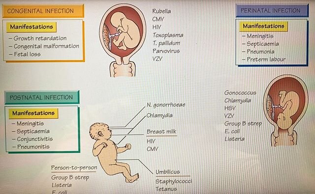 As you prepare for your step 2 and 3 don&rsquo;t forget about your congenital, perinatal and postnatal infections. At USMLEGRANDMASTER LLC you will learn all pathways to have the highest score. 97% passing rate with over 180 students. Link above for 