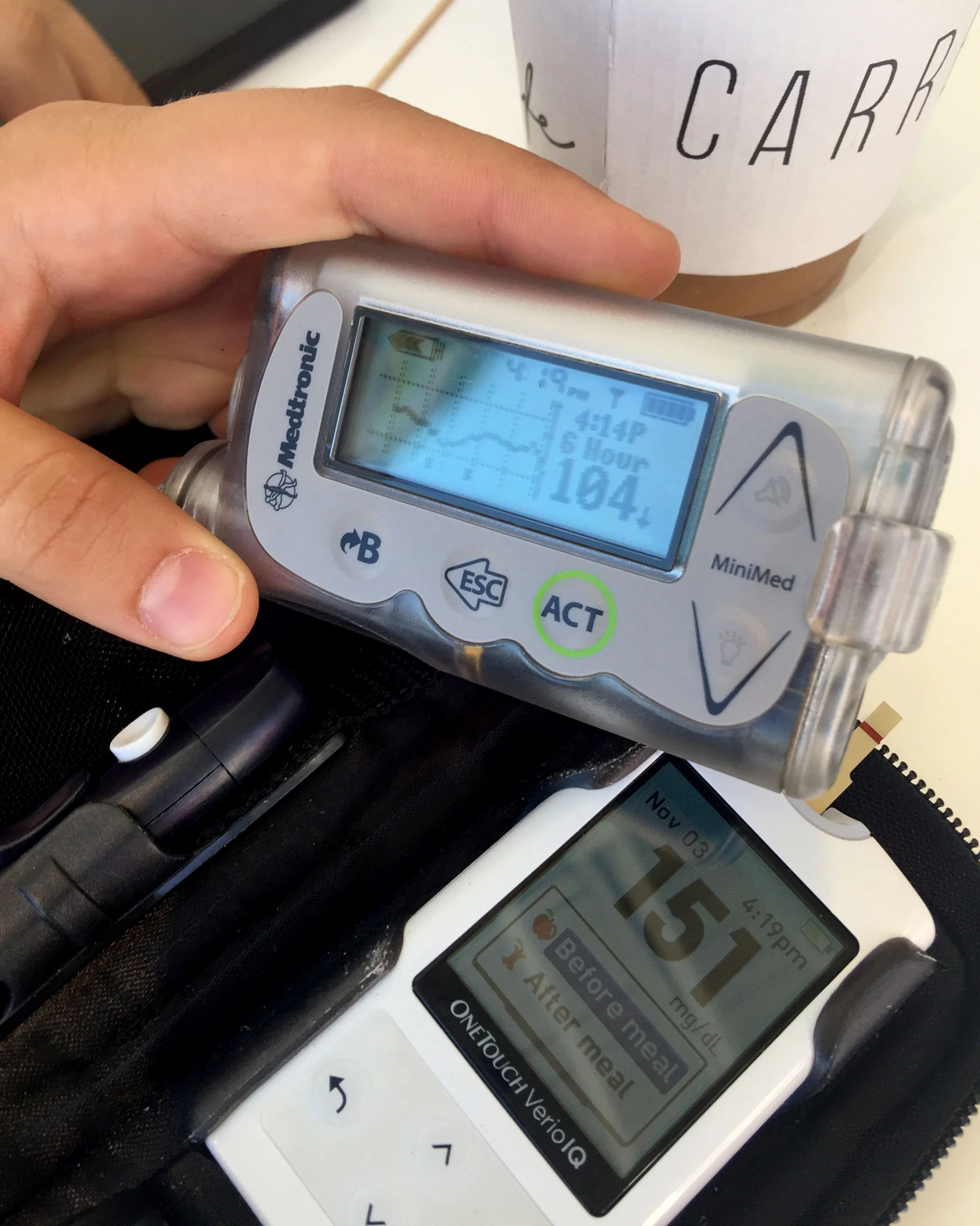 Laura Pavlakovich, founder of the nonprofit “You’re Just My Type” checks her blood glucose, and calibrates her insulin pump accordingly while on a shoot in Los Angeles on Nov. 3, 2016.