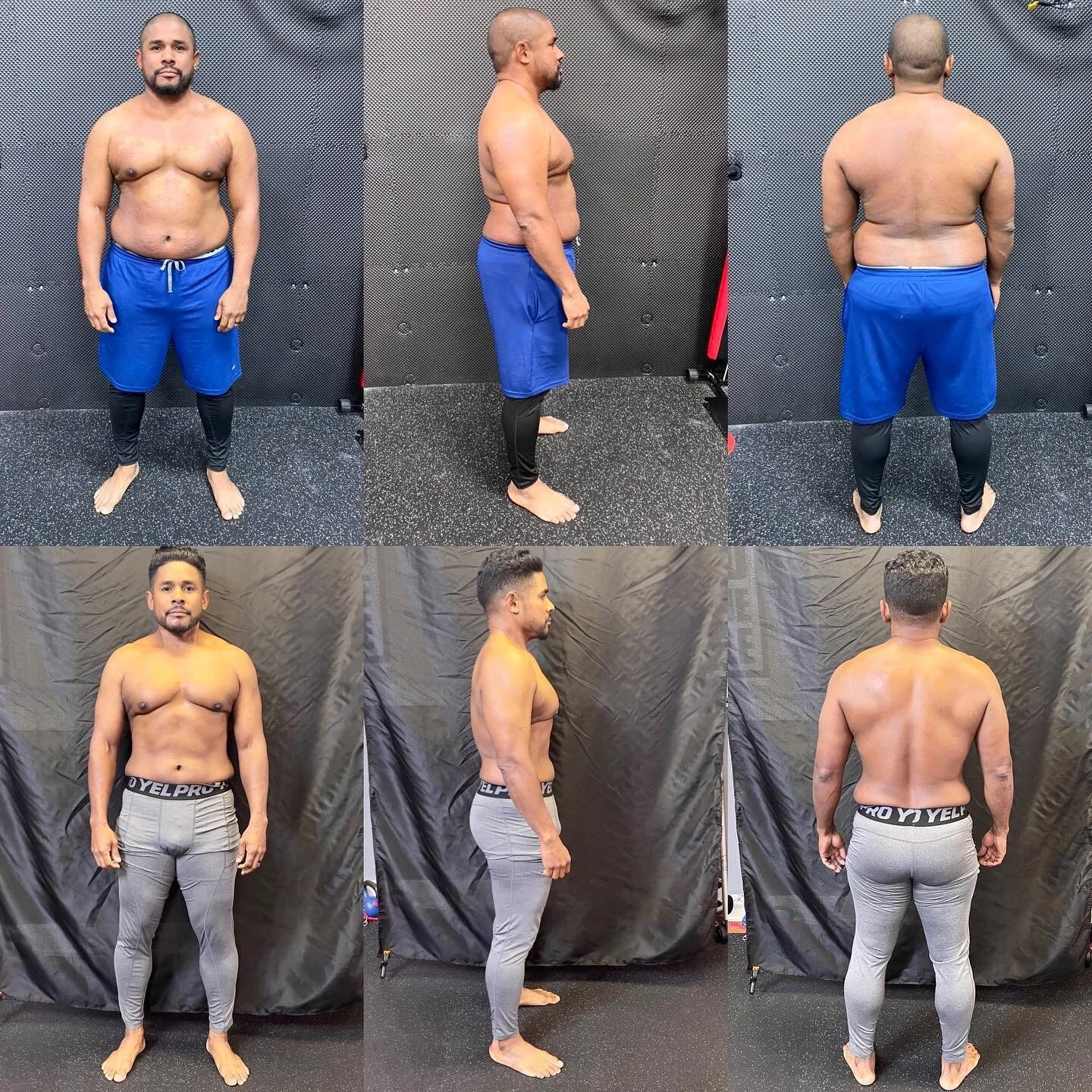 Pain, Gait & Physique Gains with @functionalpatterns @naudiaguilar 
Barjes - @barj3s 
BEFORE: 9/12/2020 
Age: 43
❌Unable to sprint due to hip pain 
❌Chronic knee pain, considering surgery
❌Excess body fat - 217lbs 
❌hyper-flacid core & hips