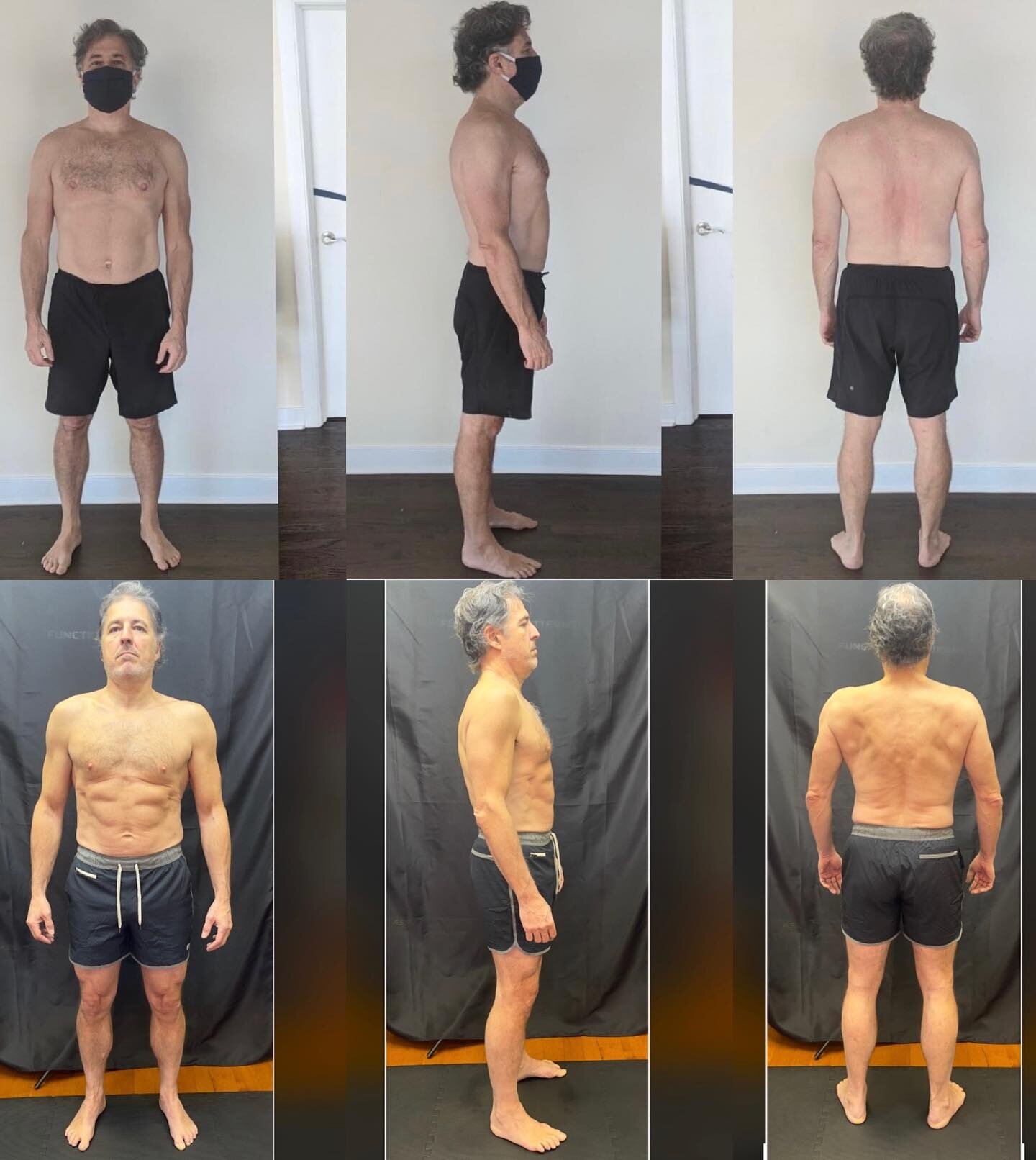 1 year Posture &amp; Gait Progress with @tonyc44jr at 57 years old! Utilizing @functionalpatterns @naudiaguilar 

Before - December 2020
🚫 Hyperflaccid structure from 15+ years of yoga 
🚫 Lack of core tension
🚫 Bloated &amp; protruding midsection 