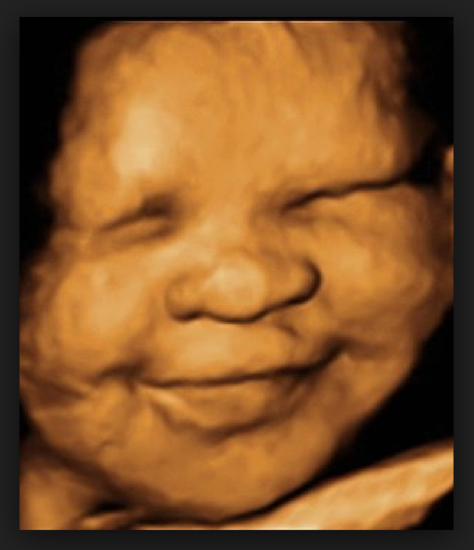 3d ultrasound.png