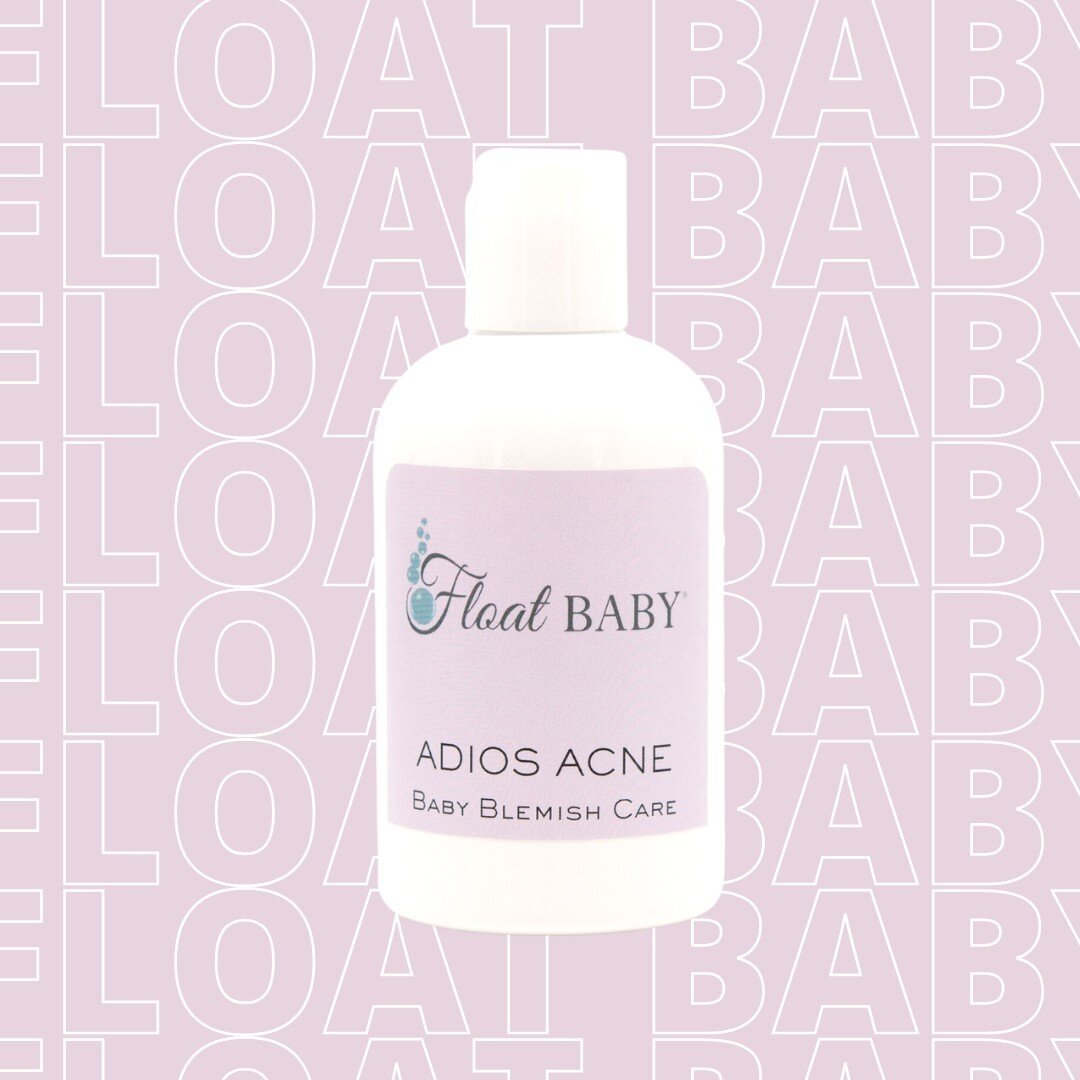 Custom blended for Float Baby by infant skin care experts. Most babies get acne, which will go away on it&rsquo;s own. This all organic product clears acne within 3-7 days depending on severity. Fresh scent, goes on like a toner. Tip: Will also remov