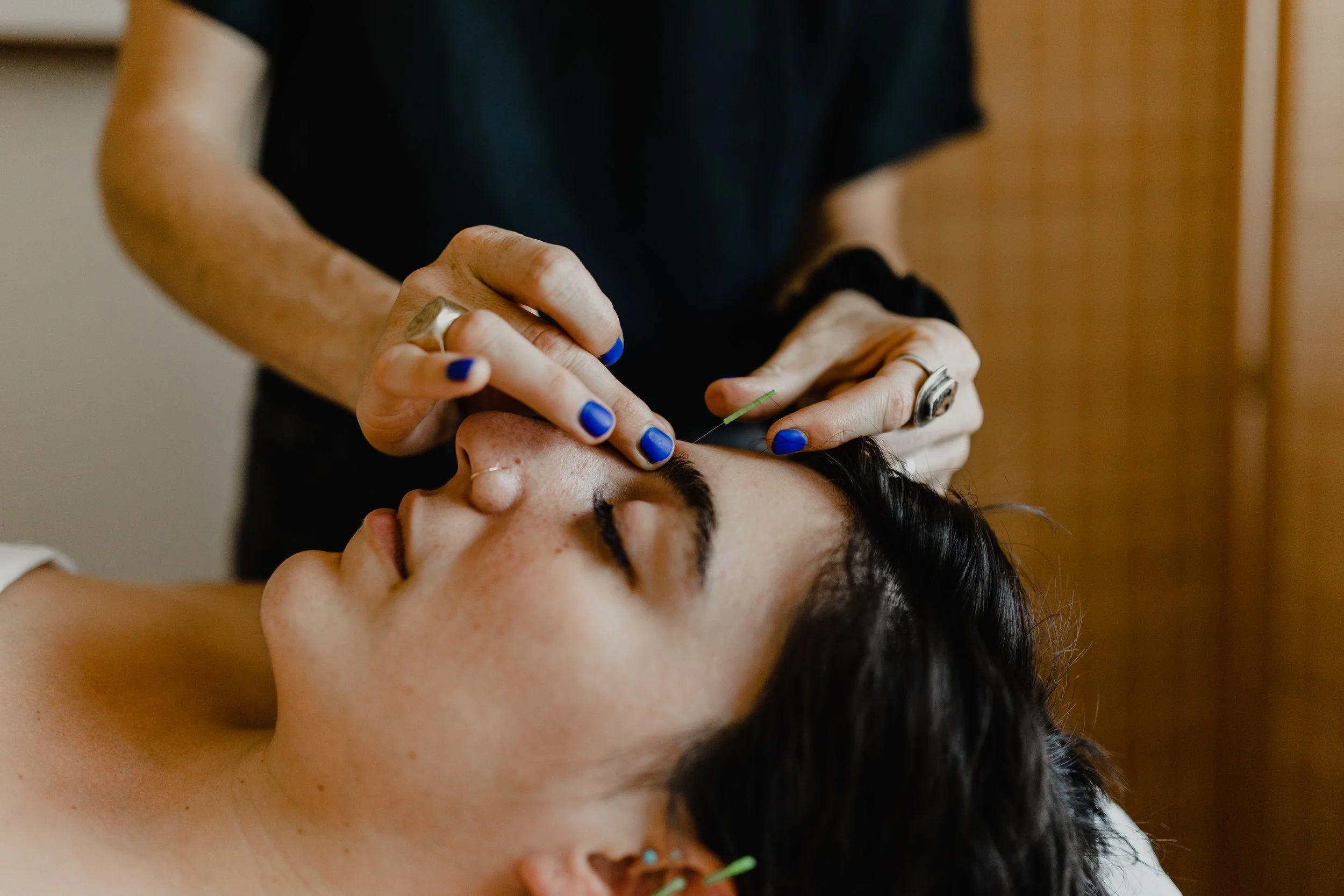 Perennial Acupuncture & Companion Medicine