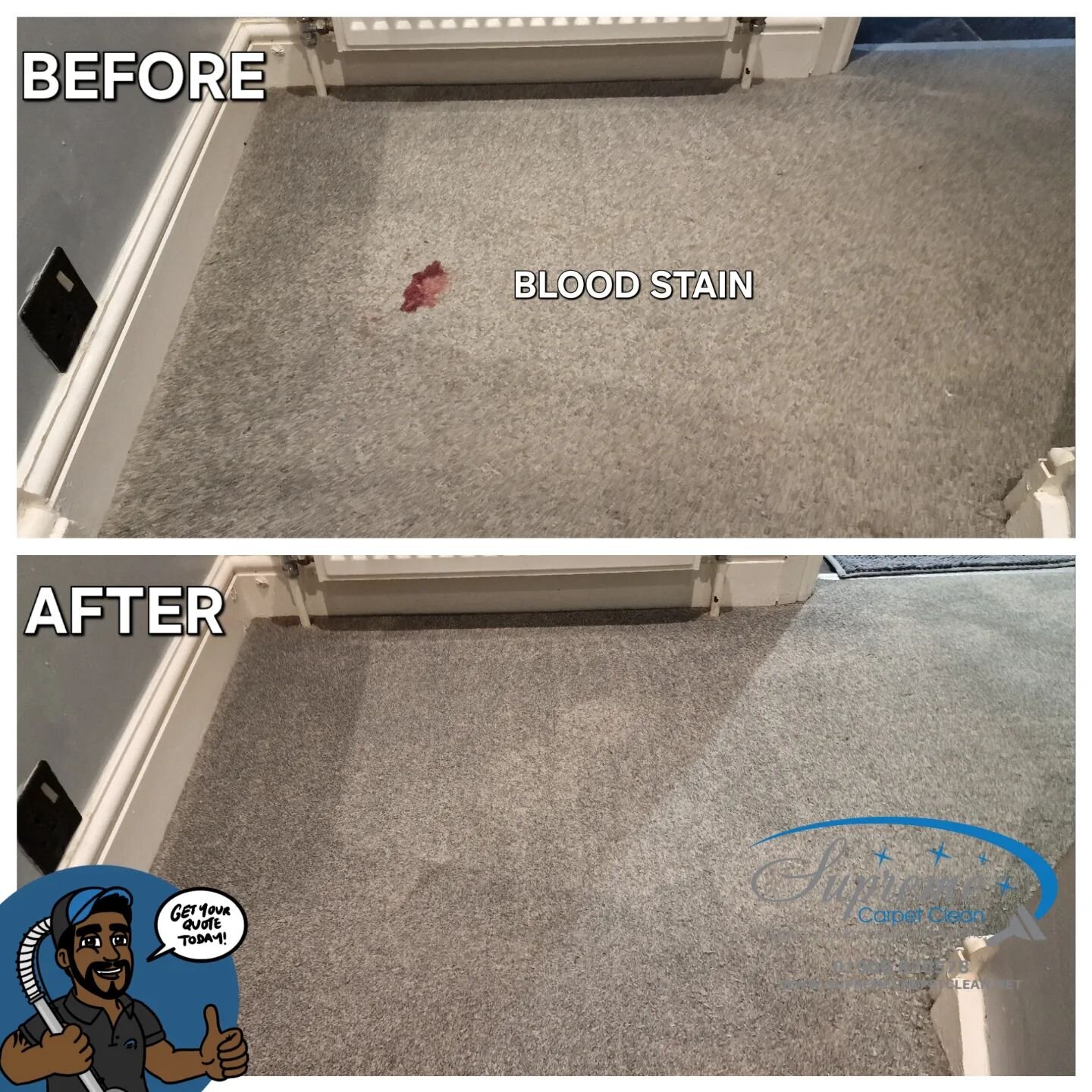 EMERGENCY CALL OUT - BLOOD STAINS ON A CARPET. Treated and cleaned. 

FREE QUOTES AVAILABLE - WE COVER NATIONWIDE
.
.
.
.
.

#carpetcleaning #Supremecarpetclean #carpetcleaningmiltonkeynes #carpetcleaningmk #cleaning #bloodoncarpet #carpetcleaningbuc