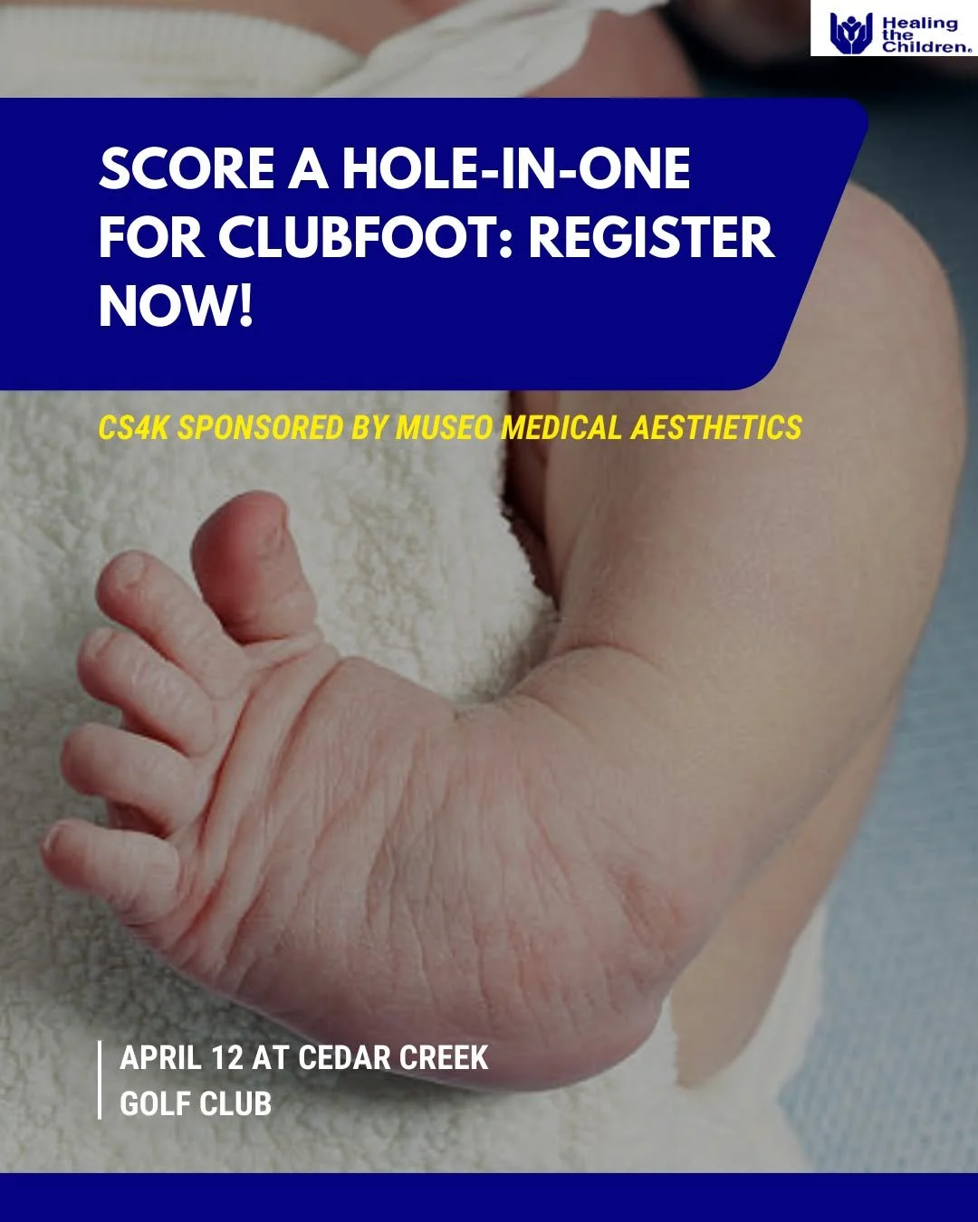 🏌️&zwj;♂️⛳ Only 4 days left to register! 

Join us on April 12 at Cedar Creek Golf Club to support children with clubfoot and help change lives. 💙👣

📅 Register now before it's too late!
📍 Cedar Creek Golf Club
🙏 Sponsored by Museo Medical Aesth