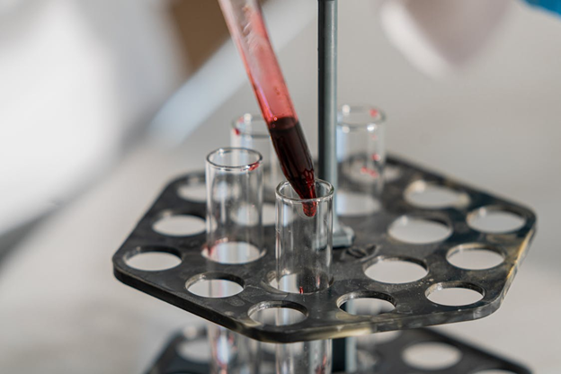 Lab Tests | ProductiveandFree