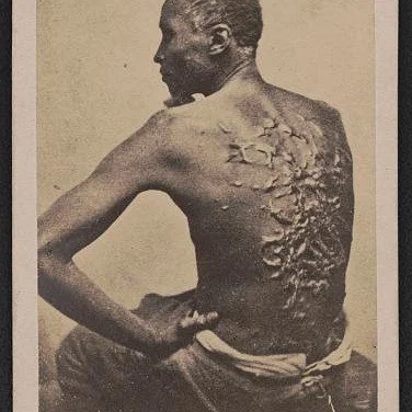 This iconic photo is being censored by the current regime. The photograph, preserved in the Library of Congress, was among the first to demonstrate how photography, a then new technology, could shift public consciousness. Published a year before the 