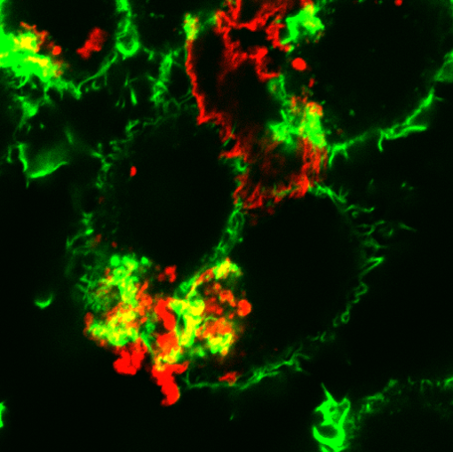 Lipoproteins (red) being digested by macrophages (green)