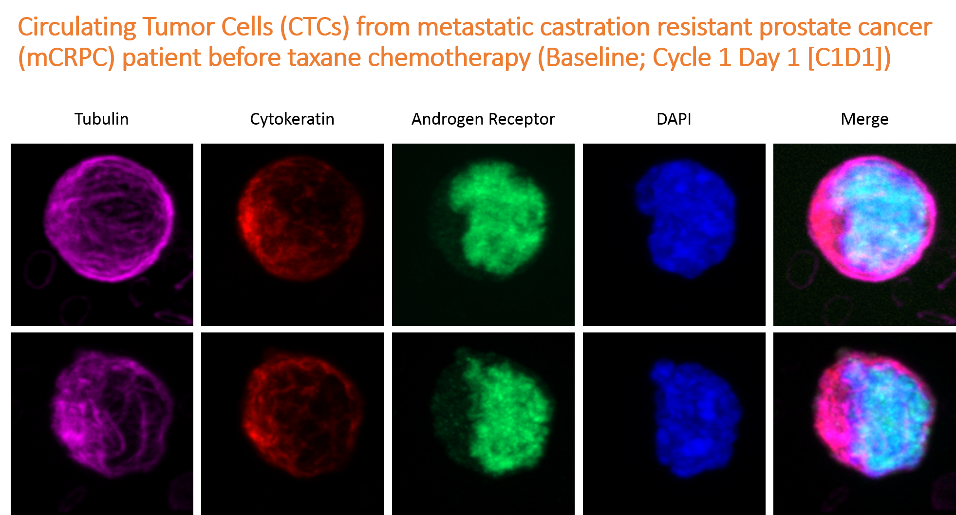 Circulating Tumor Cells (CTCs) pre-treatment with taxane